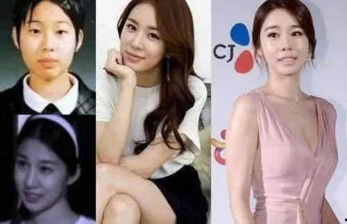 韩国整容成功的女明星