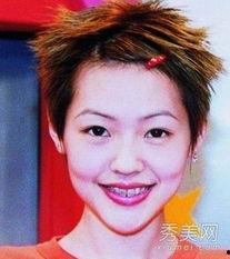 拔牙明星,揭秘明星口腔健康之路